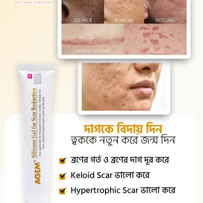 AGEM Silicone Gel 30g